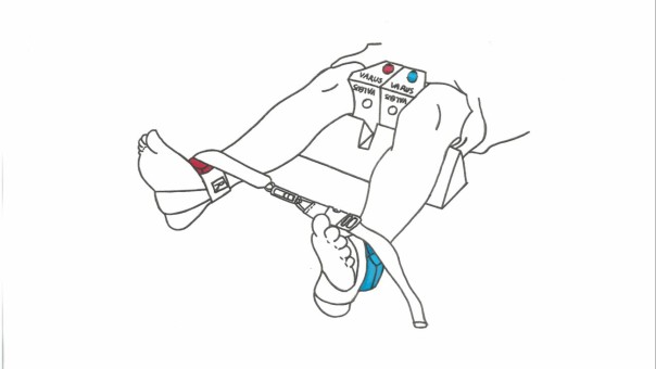 OSSKAR positions the lower limb for valgus and varus stress imaging of the knee using a standardised technique, for assessment of the pattern and severity within the medial and lateral compartments of the adult knee.
For more information: https://www.askorn.bzh/en/osskar/